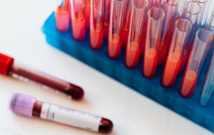 Njemački mediji otkrili: Milijarde eura nestale na poslovima s PCR testovima