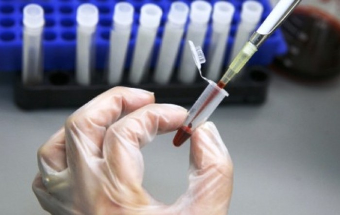 Moderna ubrzava rad na cjepivu protiv koronavirusa