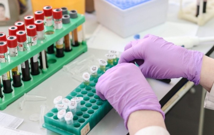 FDA: Nove varijante mogle bi utjecati na lažno negativne rezultate PCR testova