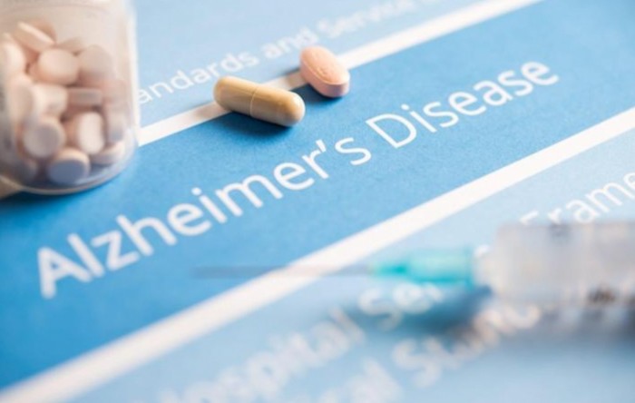 SAD odobrio prvi novi lijek za Alzheimerovu bolest u posljednjih 20 godina