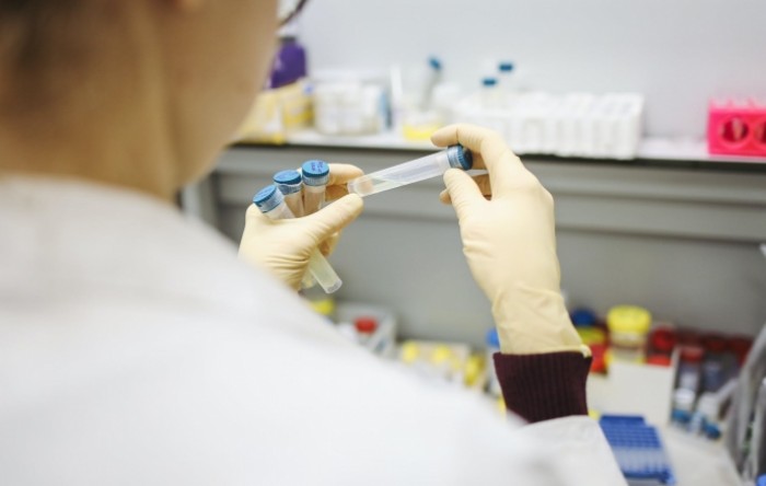 U Sloveniji cijepljenje ubuduće isključivo mRNA cjepivima