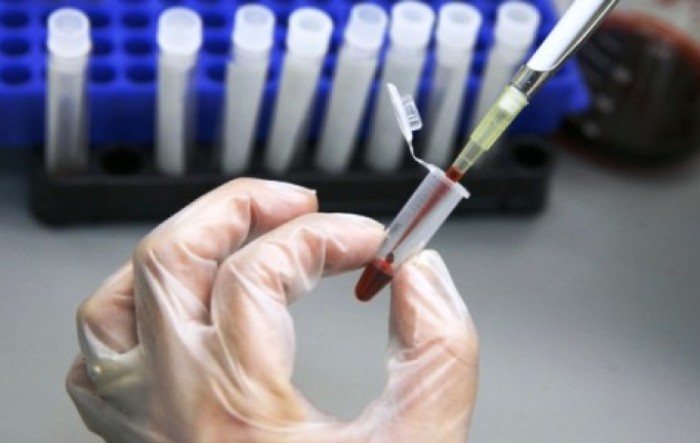 Rusija planira masovnu proizvodnju cjepiva protiv covida-19 ove godine