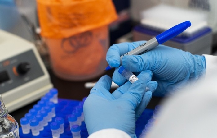 Britanija će testirati krvnu plazmu pacijenata koji su preboljeli koronavirus