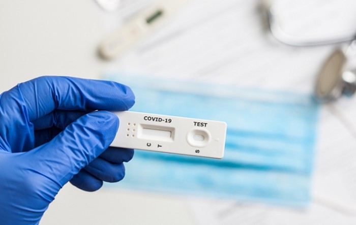 Dogovor članica EU-a o međusobnom priznavanju antigenskih testova