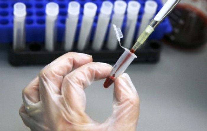 I Slovenci razvijaju potencijalno cjepivo za koronavirus