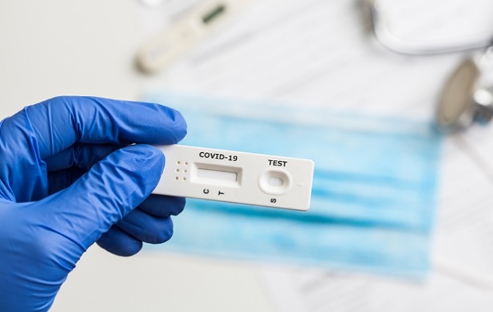 Slovenija: Od 23. kolovoza više nema besplatnih antigenskih testova